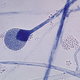 Image for article titled Oh Crap, Fungus Can Grow In Your Brain